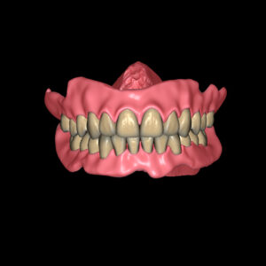 Denture Design Product Image