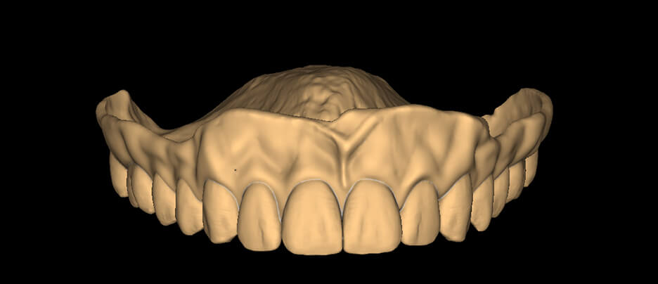 Monolithic Denture- Round - Natural