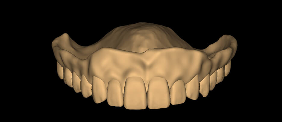 Monolithic Denture - Square - Natural