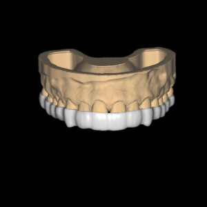 Occlusal Guard Design Product Image