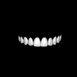 Veneers Design Product Image