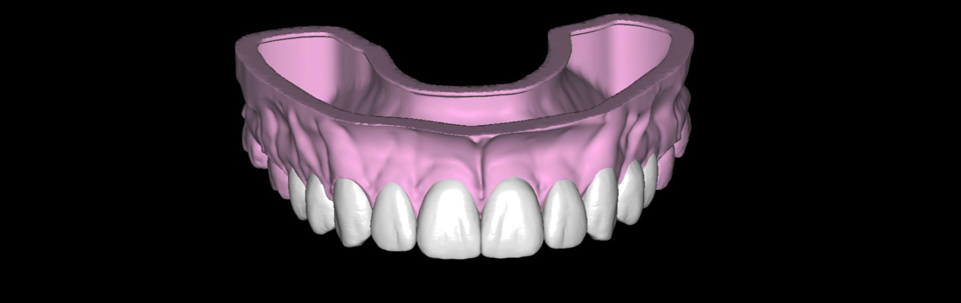 Smile Trial